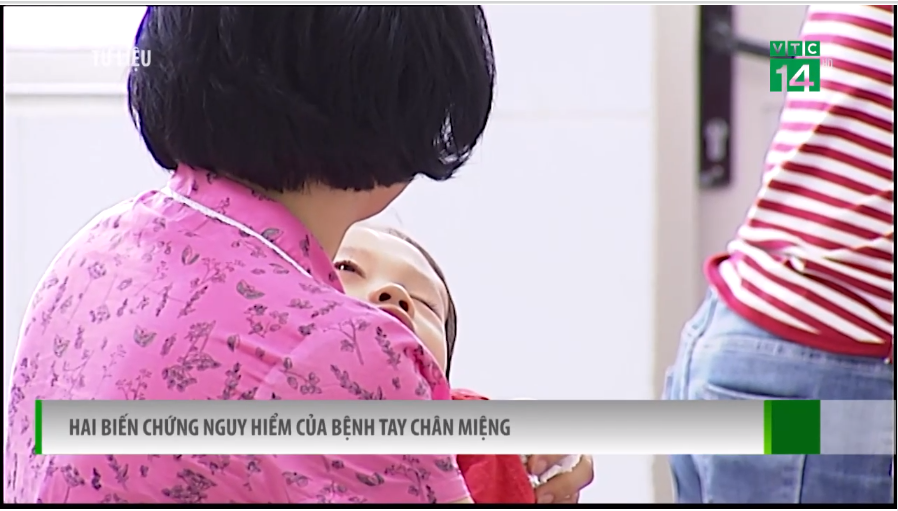 Hai biến chứng nguy hiểm của bệnh tay chân miệng