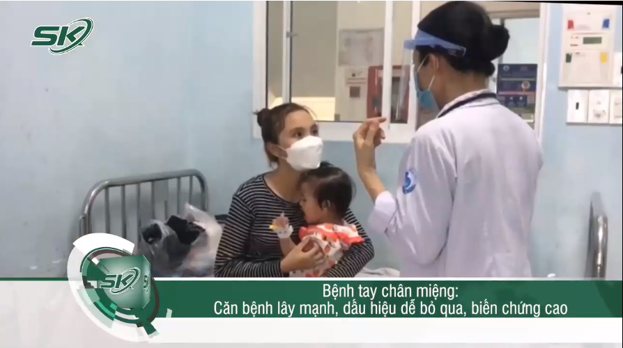 Dấu hiệu không thể bỏ qua của bệnh chân tay miệng, phụ huynh cần lưu lại