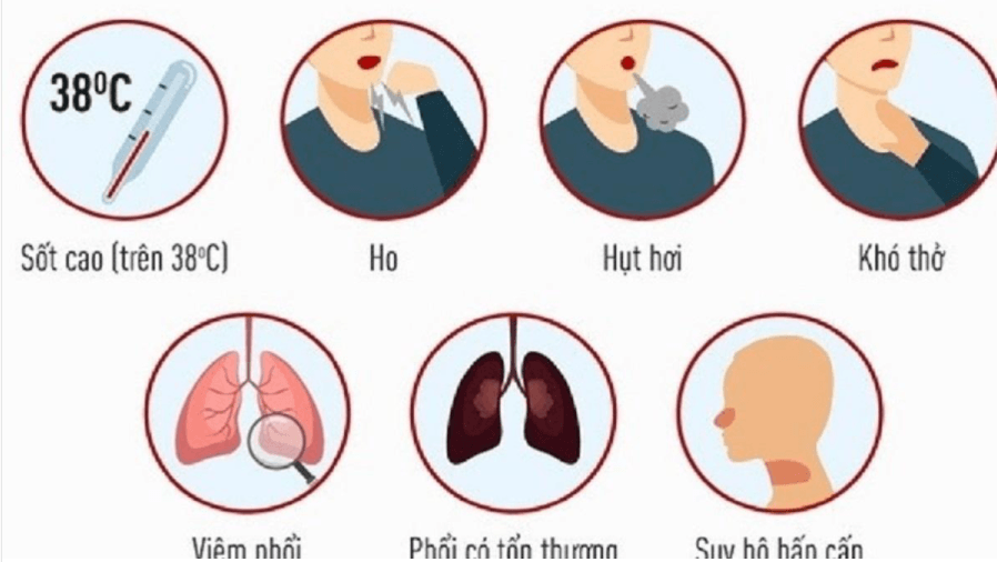 Một số triệu chứng lâm sàng khi nhiễm Covid-19